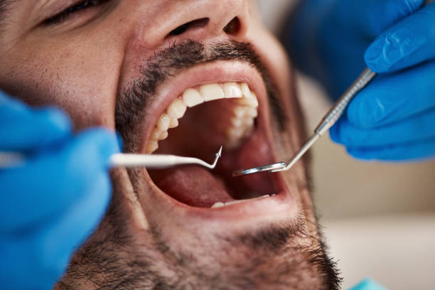 Best Dentist for Tooth Abscess  in North East, MD
