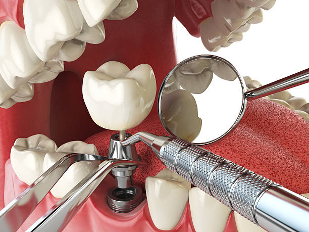 Best Cracked Tooth Emergency Dentist  in North East, MD